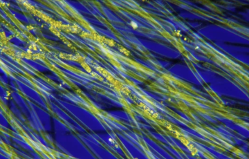 Filamentous cyanobacteria under a microscope.