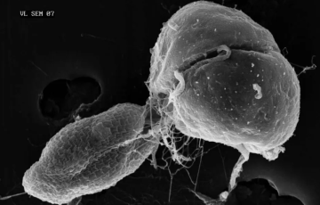 SEM of K. veneficum ingesting a cryptophyte its favorite prey