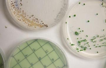 algae cultures in petri dishes 
