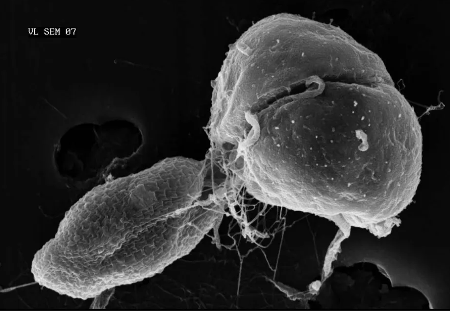 SEM of K. veneficum ingesting a cryptophyte its favorite prey